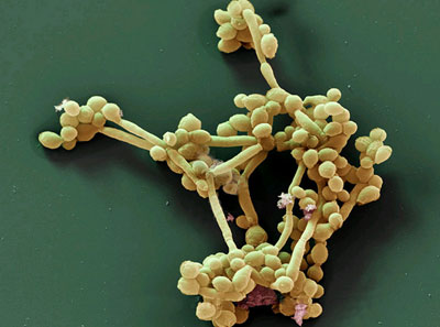 Грибок Candida albicans Грибок Candida albicans