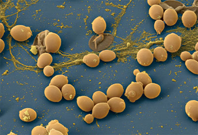 грибок Candida